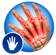 Prise en charge médicale arthrite