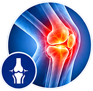 Prise en charge médicale arthrose